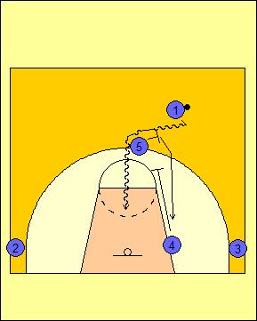 Pick and Roll Offense: High Screen the Screener (Quick Hitter ...